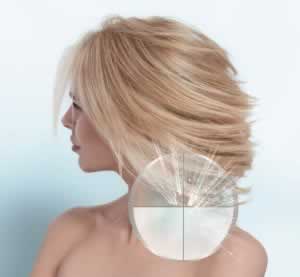 nioxin soluții personalizate împotriva căderii părului
